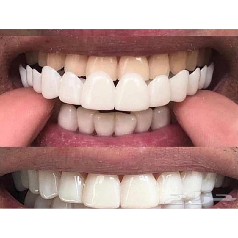 Dental Snap Smile Dental Upper False Fake Teeth Cover Perfect Smile Veneers Comfort Fit Flex Whitening Denture Braces Equipment